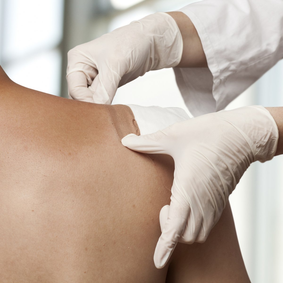 Innovating chronic wound treatment